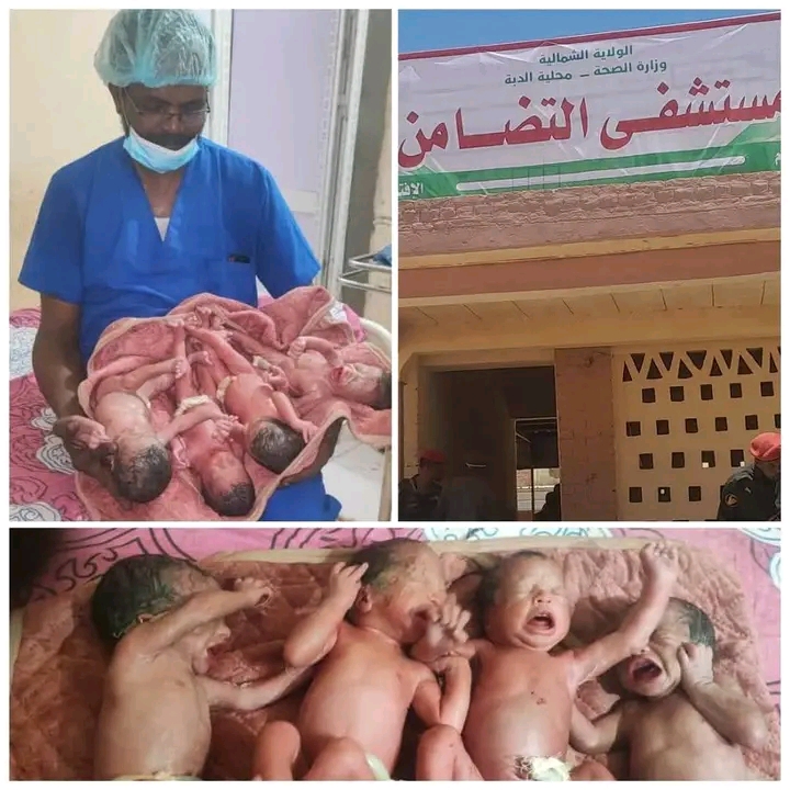 في إنجاز طبي هو الأول من نوعه بالمنطقة.. مستشفى التضامن بالدبة ينجح في توليد أربعة توائم عبر عملية قيصرية 1 1781372242978